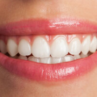Cure dentistiche all'estero: perché sempre più italiani scelgono la Croazia